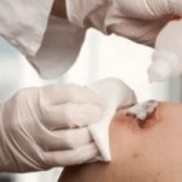 نگهداری از بیمار زخم بستری