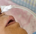 نگهداری از بیمار گاواژی